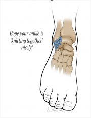 Healing Ankle