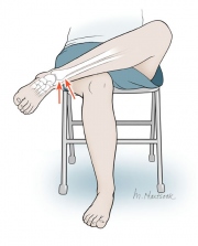 Crossed Leg Test for Ankle Sprain