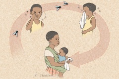 Trachoma Cycle Trachoma Cycle