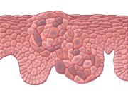 Cancer Cells