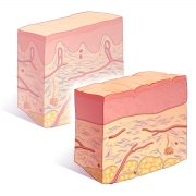 Comparison of Young and Aging Skin